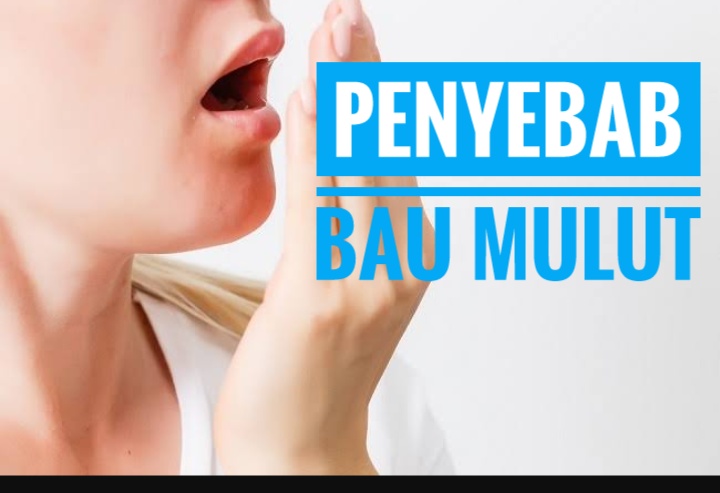 Pahami 6 Faktor Penyebab Bau Mulut dan Begini Tips Pencegahannya 