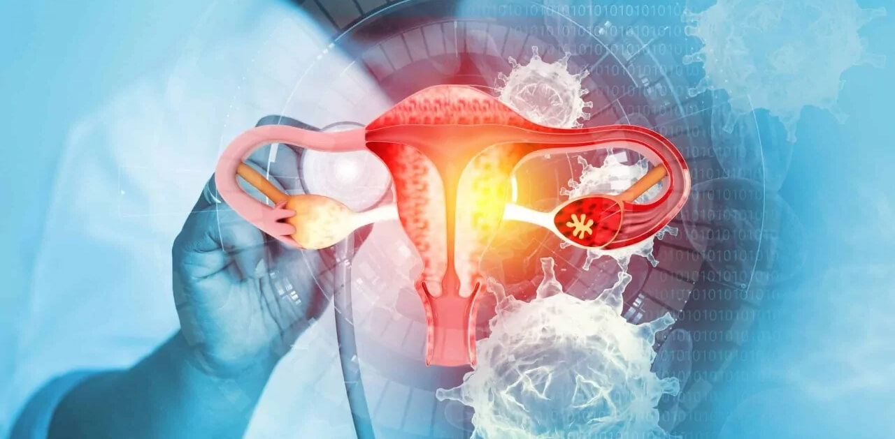  Tekan Kanker Serviks Pembunuh Wanita Indonesia, Ini Langkah Menkes RI