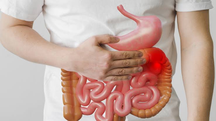 Ini Pemicu Penyakit Usus Buntu