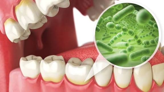 Minuman yang Menyebabkan Noda pada Gigi, Yuk Simak Kata dr. Miles