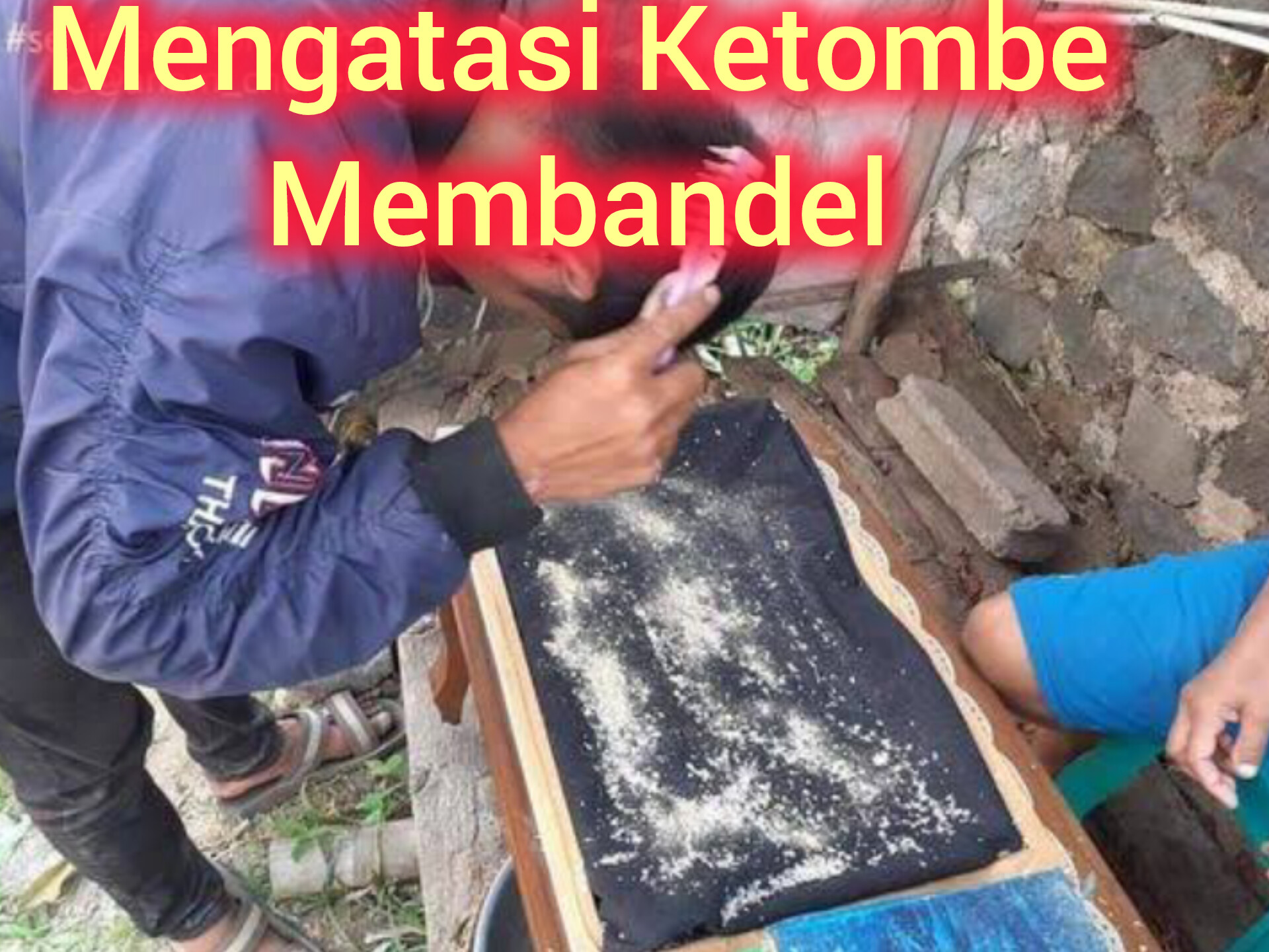 Begini Cara Mengatasi Ketombe Membandel dengan Berbagai Cara Ampuh