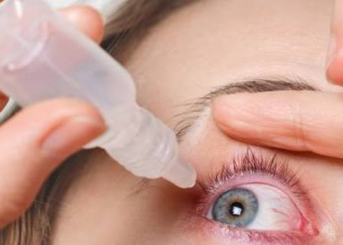 Hukum Menggunakan Obat Tetes Mata saat Berpuasa, Batal atau Tidak? Yuk Simak