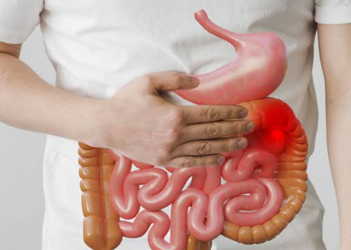 Ini Pemicu Penyakit Usus Buntu