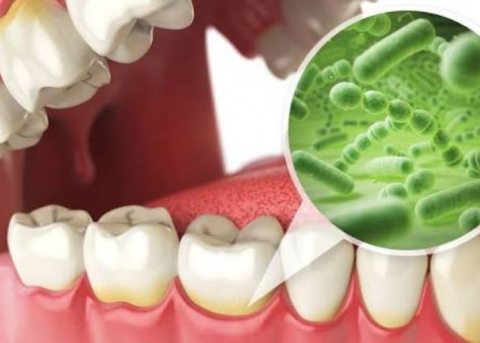 Minuman yang Menyebabkan Noda pada Gigi, Yuk Simak Kata dr. Miles