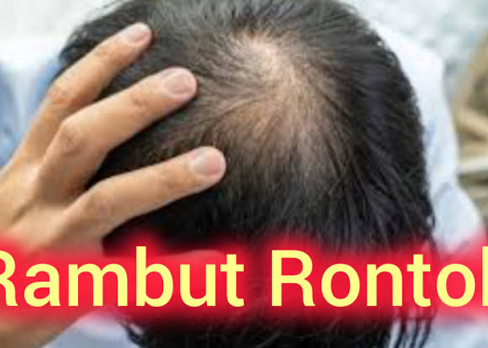 Ini 5 Penyebab Rambut Menjadi Rontok dan Berikut Cara Mengatasinya