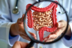 Yuk Batasi! Inilah 4 Minuman yang Dapat Menyebabkan Kerusakan Usus jika Berlebihan Mengkonsumsinya 