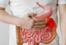 5 Makanan Fermantasi Ini Dapat Meningkatan Kesehatan Usus dan Mencegah Kebotakan Hingga Kesehatan Kulit