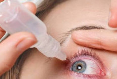 Hukum Menggunakan Obat Tetes Mata saat Berpuasa, Batal atau Tidak? Yuk Simak